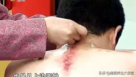 刮痧后運動可以嗎_刮痧后多久可以運動_運動刮痧可以后天天刮嗎
